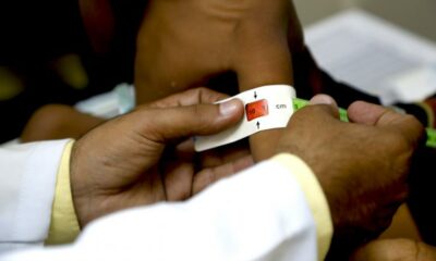 An Estimated 10.4 Million Children In The DRC, Northeast Nigeria, The Central Sahel, South Sudan And Yemen Will Suffer From Acute Malnutrition In 2021 - UNICEF Brandnewsday